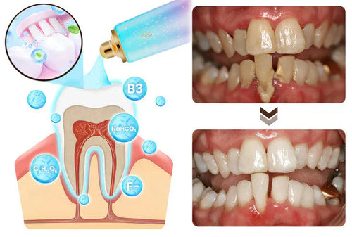 Dentifrice au Niacinamide - Souriez en toute confiance BODYARCEL