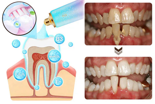 DENTIFRICE BLANCHISSANT À LA NIACINAMIDE