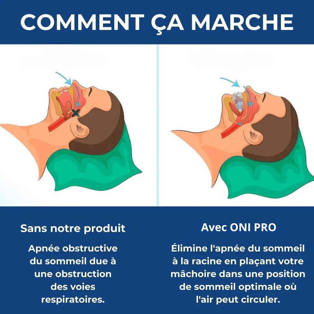 AirFlow™ - Dispositif contre le ronflement et l'apnée du sommeil