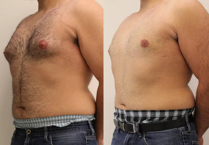 Capsules de testostérone turkestérone tongkat ali - Puissance, Énergie & Croissance Musculaire