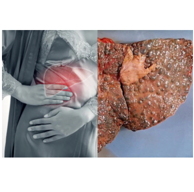 Thé de Foie Naturel