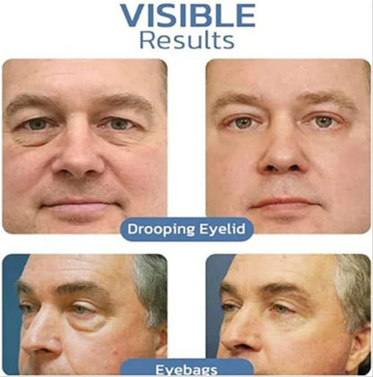 Crème Anti-Cernes & Anti-Rides – Regard Jeune & Éclatant