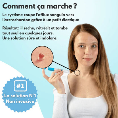 Kit DermaSkin Pro™ – Adieu Les Acrochordons, Résultat Immédiat