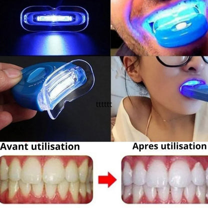 Kit de blanchiment des dents avec lumière LED