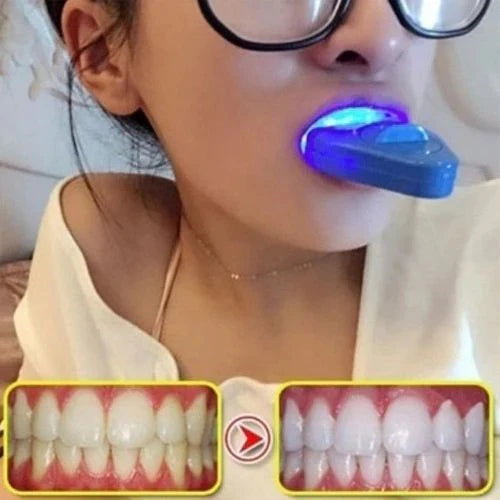 Kit de blanchiment des dents avec lumière LED