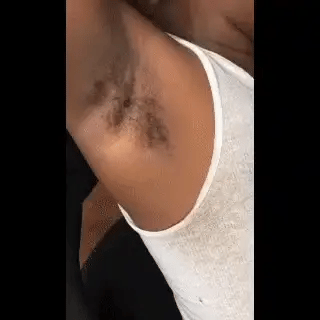 Spray Épilatoire Corps