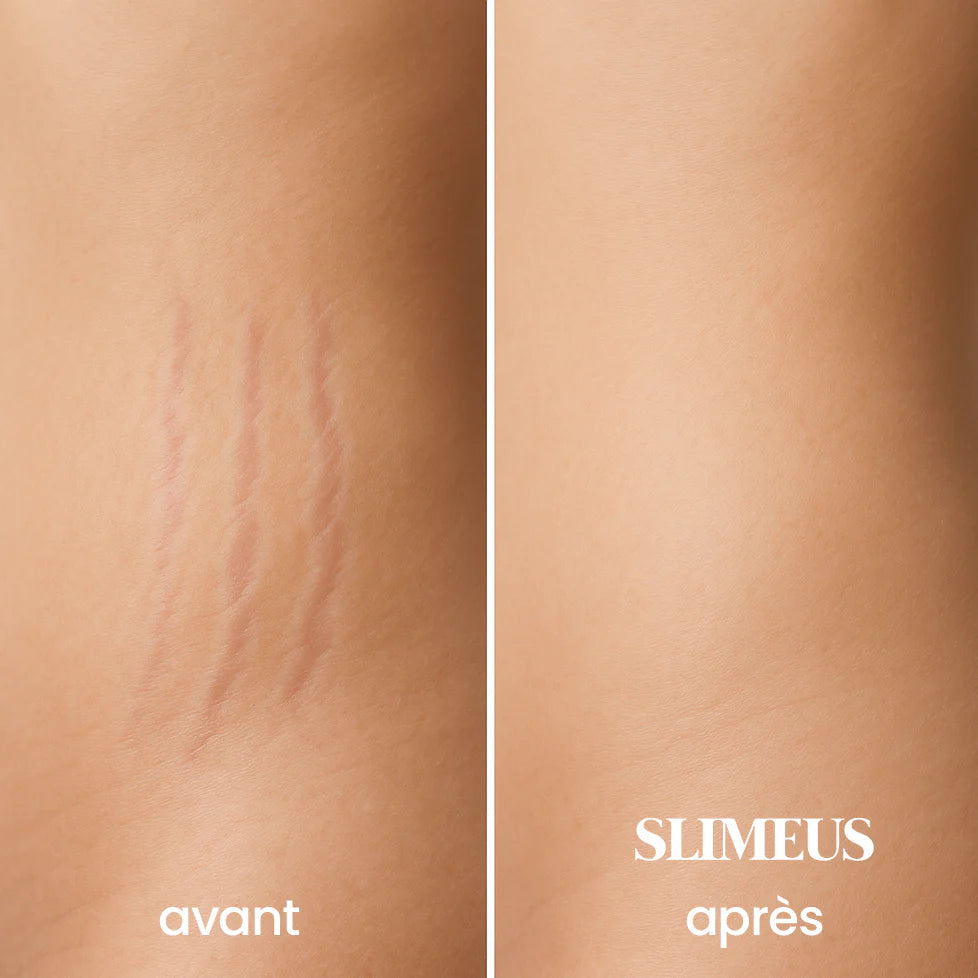 Slimeus -Crème minceur & vergeture