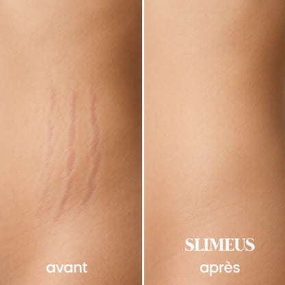 Slimeus -Crème minceur & vergeture